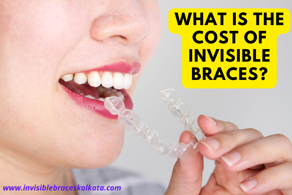 invisible braces cost in kolkata